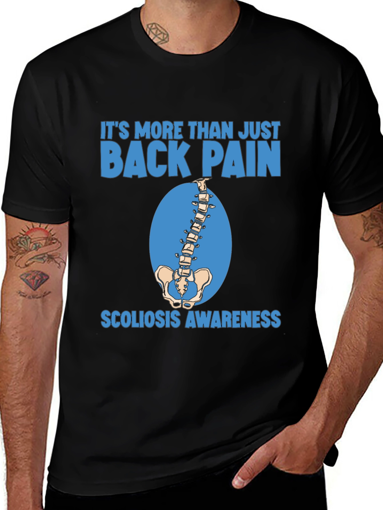 Scoliosis Awareness T-Shirt - More Than Back Pain